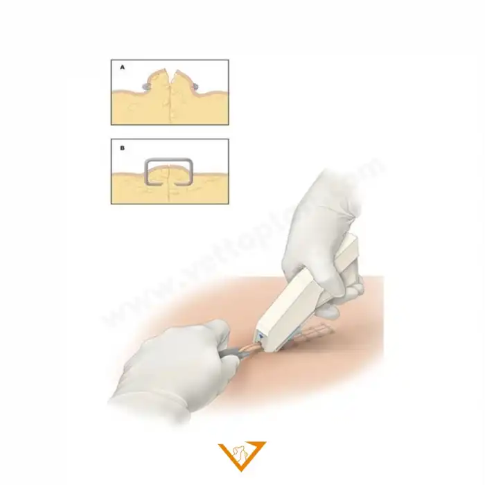 Bestpoint Cilt Stapleri