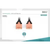Digitus CAT 6 U/UTP LSZH Patch Cord Kablo - 10 Metre, Siyah