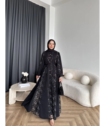 Ng - Napoli Dantel Detaylı Elbise - Siyah