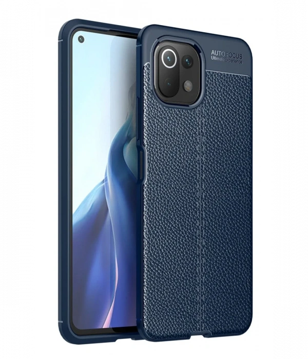 Newface Xiaomi Mİ 11 Lite Kılıf Auto Focus Kapak