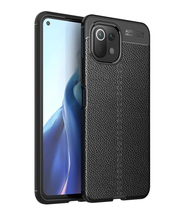 Newface Xiaomi Mİ 11 Lite Kılıf Auto Focus Kapak