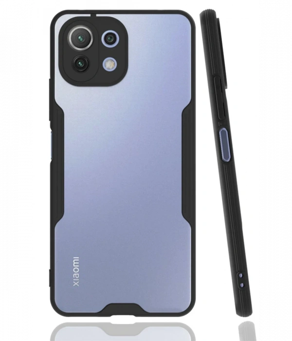 Newface Xiaomi Mİ 11 Lite Kılıf Platin Silikon