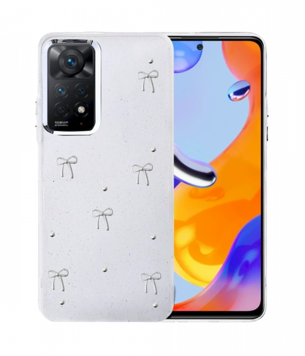Newface Xiaomi Redmi Note 11 Pro Fiyonk Desenli Kapak