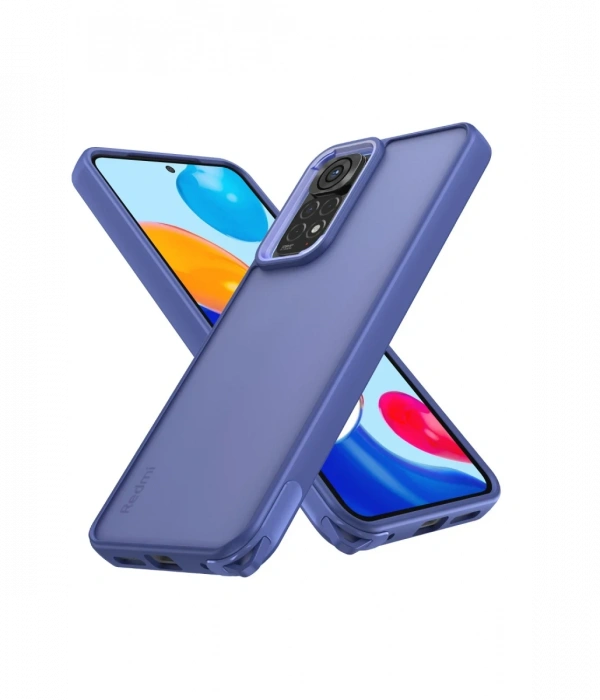 Newface Xiaomi Redmi Note 11 Pro Kılıf Elegant Kapak