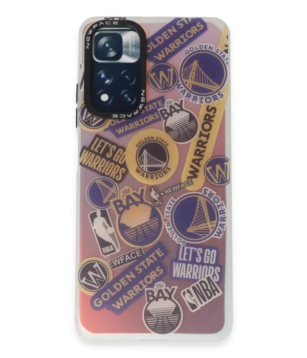Newface Xiaomi Redmi Note 11 Pro Kılıf Estoril Desenli Kapak