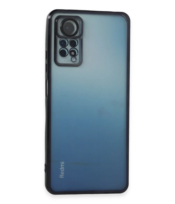 Newface Xiaomi Redmi Note 11 Pro Kılıf Razer Lensli Silikon