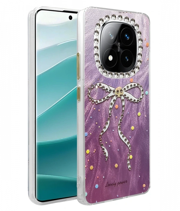 Xiaomi Redmi Note 14 Pro 4G Kılıf Blade Aynalı Desenli Kapak