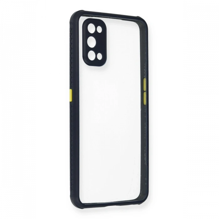 Newface Realme 7 Pro Kılıf Miami Şeffaf Silikon
