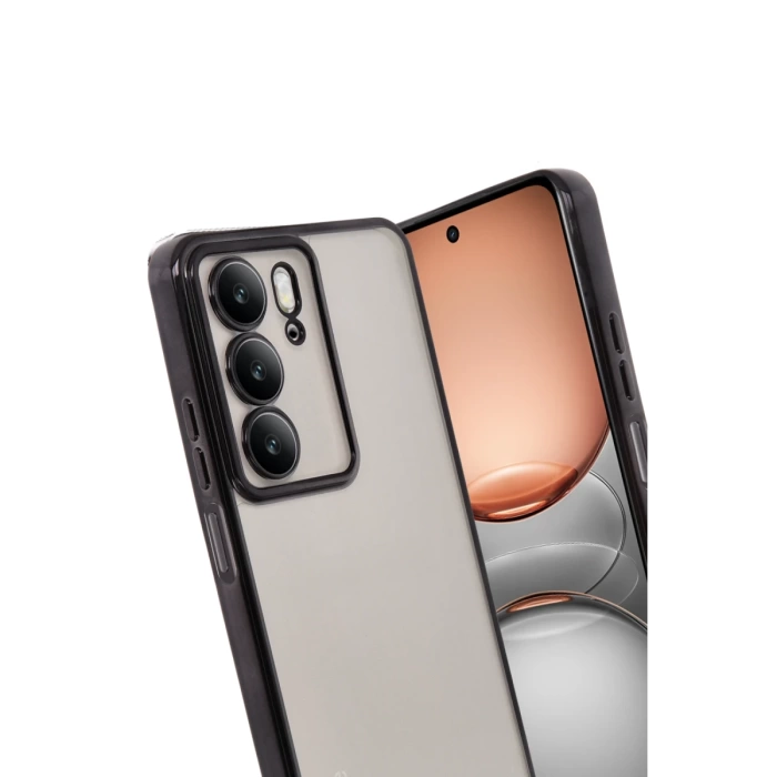 Newface Realme C75 4G Kılıf Razer Lensli Silikon