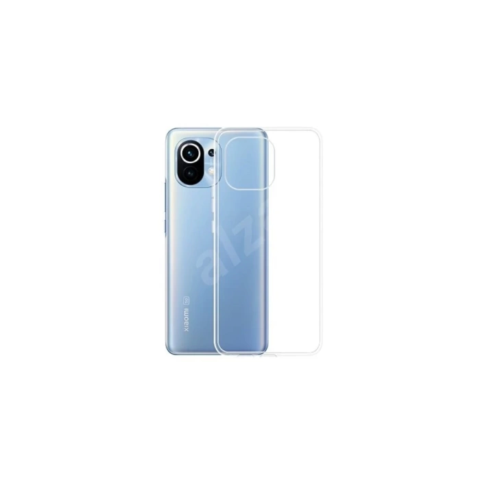 Newface Xiaomi Mi 11 Kılıf Lüx Şeffaf Silikon
