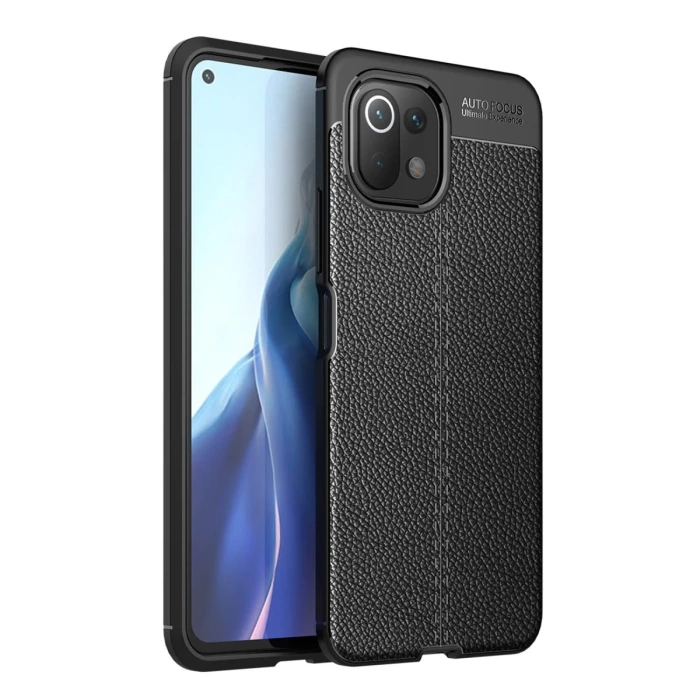 Newface Xiaomi Mİ 11 Lite Kılıf Auto Focus Kapak