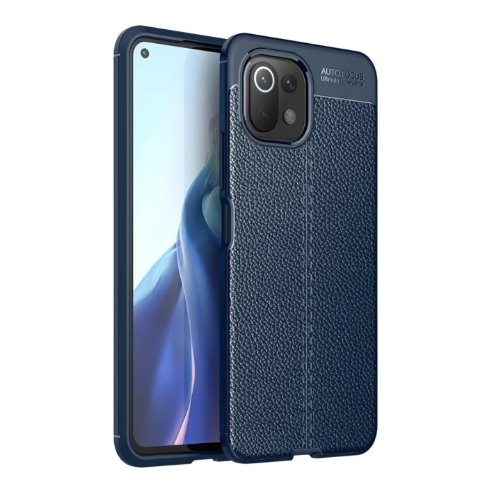 Newface Xiaomi Mİ 11 Lite Kılıf Auto Focus Kapak