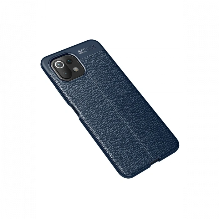 Newface Xiaomi Mİ 11 Lite Kılıf Auto Focus Kapak
