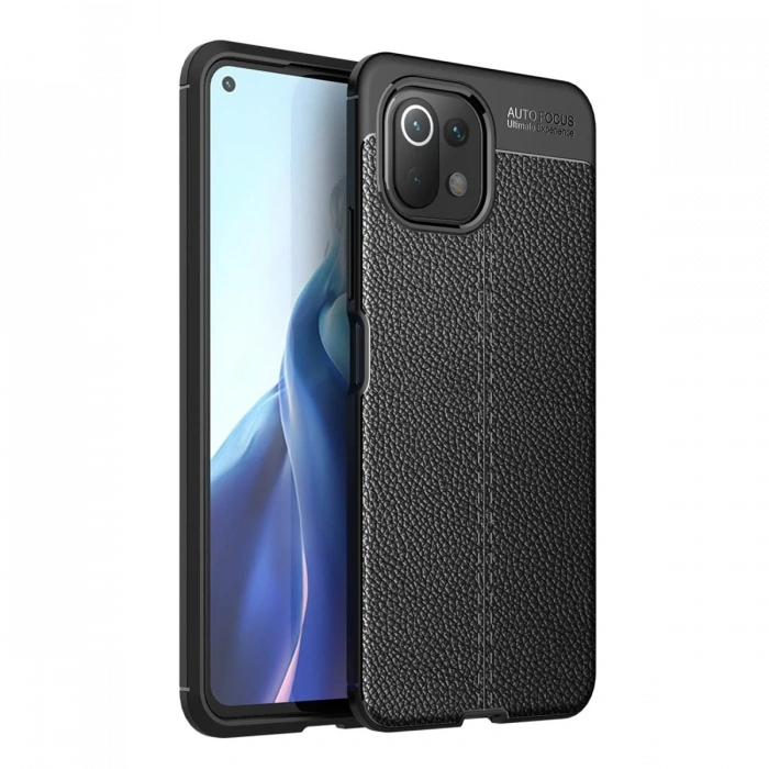 Newface Xiaomi Mİ 11 Lite Kılıf Auto Focus Kapak