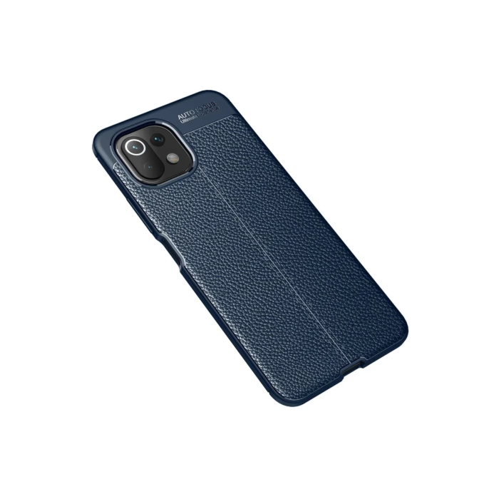 Newface Xiaomi Mİ 11 Lite Kılıf Auto Focus Kapak