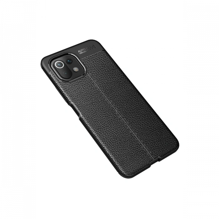 Newface Xiaomi Mİ 11 Lite Kılıf Auto Focus Kapak