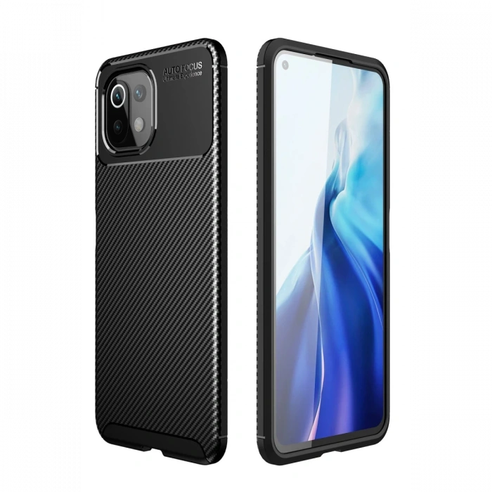 Newface Xiaomi Mİ 11 Lite Kılıf Auto Focus Karbon Kapak