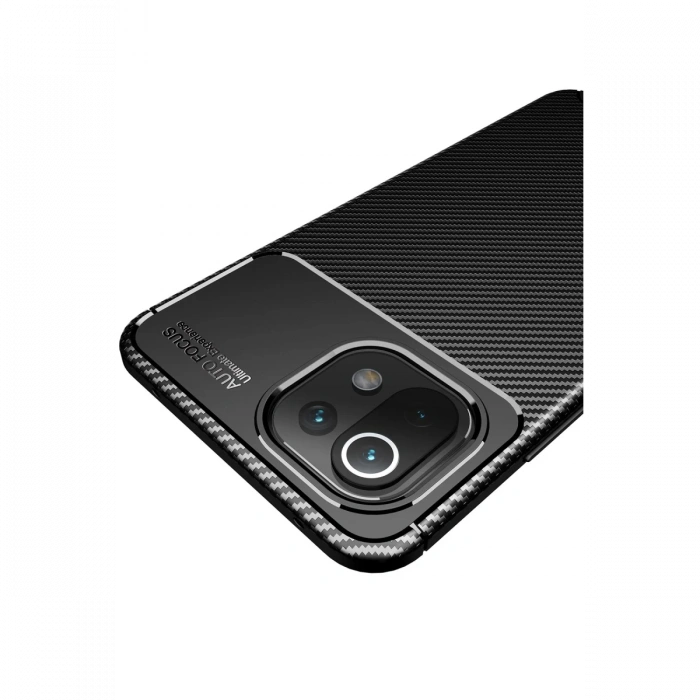 Newface Xiaomi Mİ 11 Lite Kılıf Auto Focus Karbon Kapak
