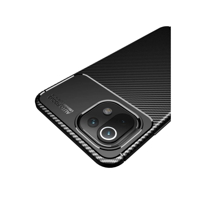Newface Xiaomi Mİ 11 Lite Kılıf Auto Focus Karbon Kapak