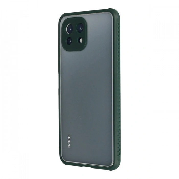 Newface Xiaomi Mİ 11 Lite Kılıf Miami Şeffaf Silikon