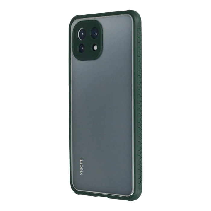 Newface Xiaomi Mİ 11 Lite Kılıf Miami Şeffaf Silikon