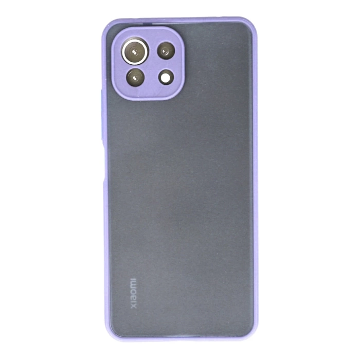 Newface Xiaomi Mİ 11 Lite Kılıf Montreal Silikon Kapak