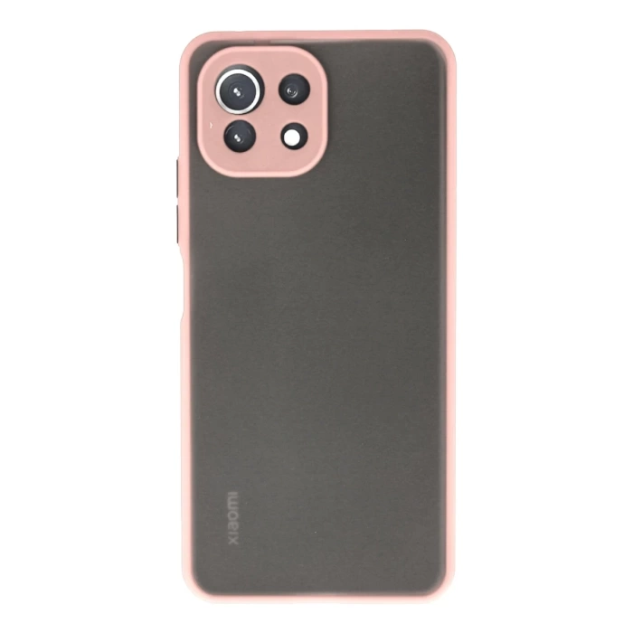 Newface Xiaomi Mİ 11 Lite Kılıf Montreal Silikon Kapak