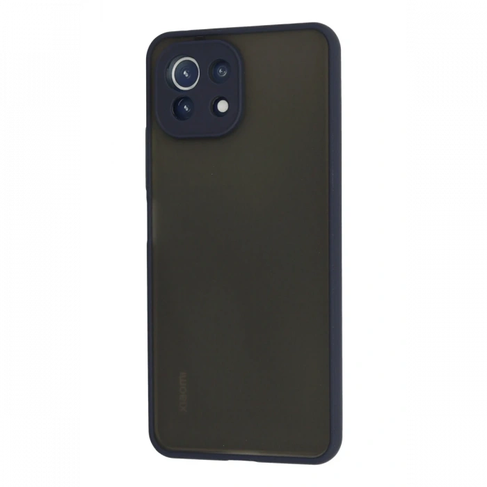 Newface Xiaomi Mİ 11 Lite Kılıf Montreal Silikon Kapak