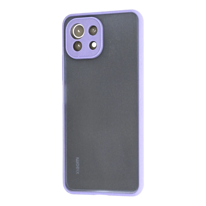 Newface Xiaomi Mİ 11 Lite Kılıf Montreal Silikon Kapak
