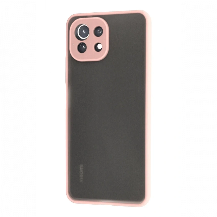 Newface Xiaomi Mİ 11 Lite Kılıf Montreal Silikon Kapak