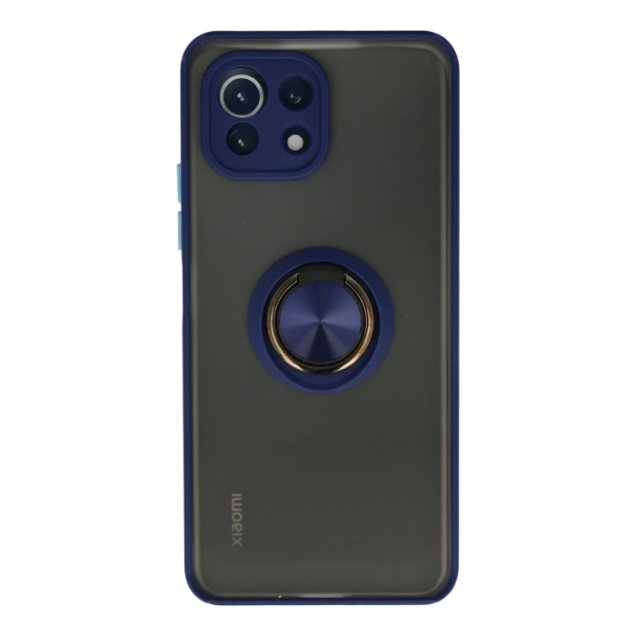 Newface Xiaomi Mİ 11 Lite Kılıf Montreal Yüzüklü Silikon Kapak
