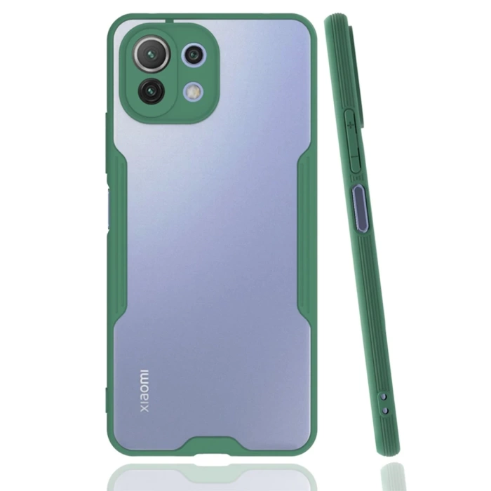 Newface Xiaomi Mİ 11 Lite Kılıf Platin Silikon