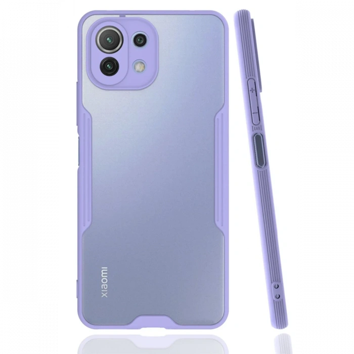 Newface Xiaomi Mİ 11 Lite Kılıf Platin Silikon