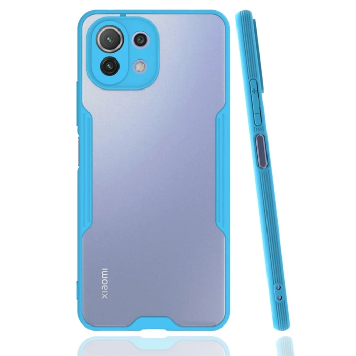 Newface Xiaomi Mİ 11 Lite Kılıf Platin Silikon