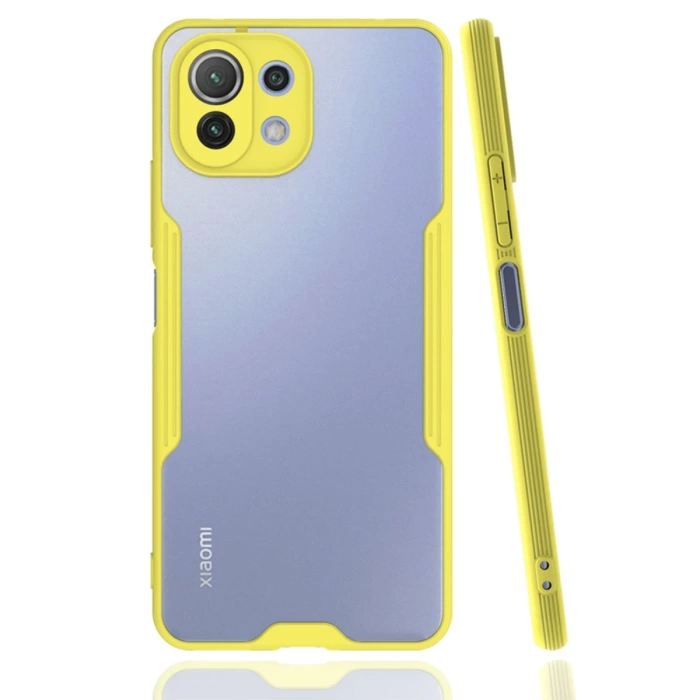 Newface Xiaomi Mİ 11 Lite Kılıf Platin Silikon