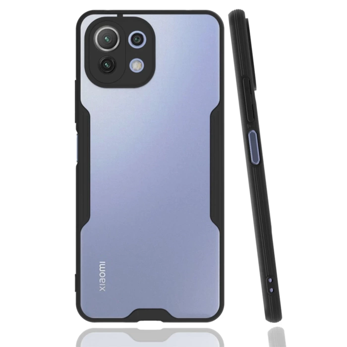 Newface Xiaomi Mİ 11 Lite Kılıf Platin Silikon