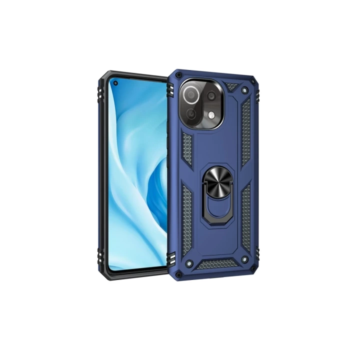 Newface Xiaomi Mİ 11 Lite Kılıf Sofya Yüzüklü Silikon Kapak