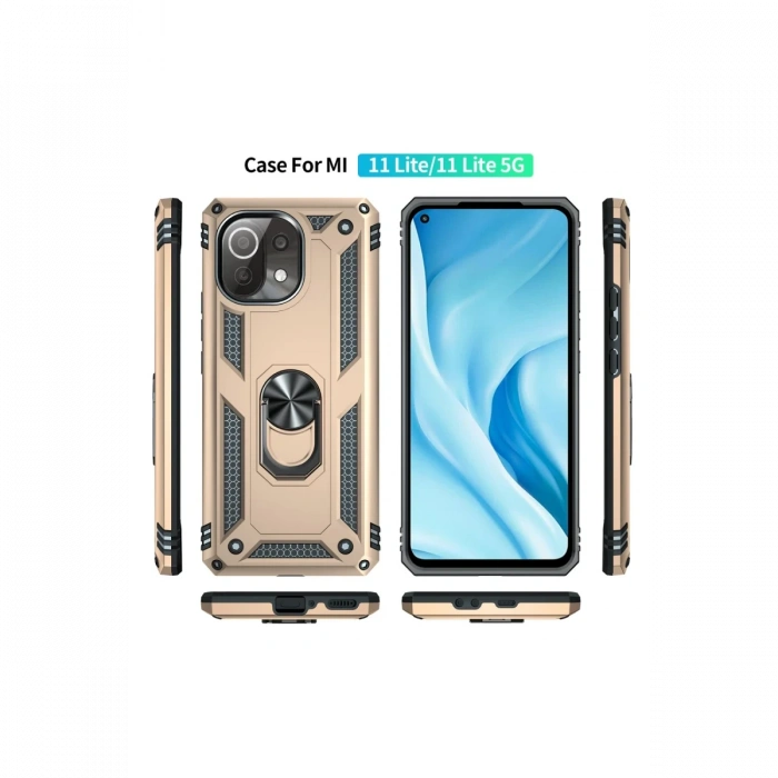 Newface Xiaomi Mİ 11 Lite Kılıf Sofya Yüzüklü Silikon Kapak