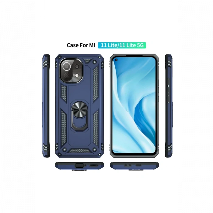 Newface Xiaomi Mİ 11 Lite Kılıf Sofya Yüzüklü Silikon Kapak