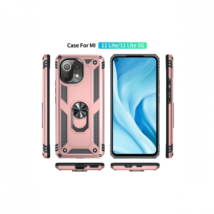 Newface Xiaomi Mİ 11 Lite Kılıf Sofya Yüzüklü Silikon Kapak