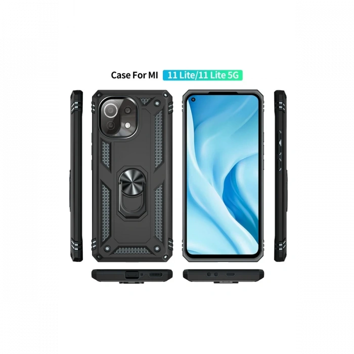 Newface Xiaomi Mİ 11 Lite Kılıf Sofya Yüzüklü Silikon Kapak