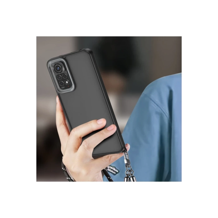 Newface Xiaomi Redmi Note 11 Kılıf Elegant Kapak
