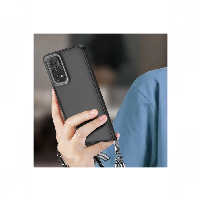 Newface Xiaomi Redmi Note 11 Kılıf Elegant Kapak