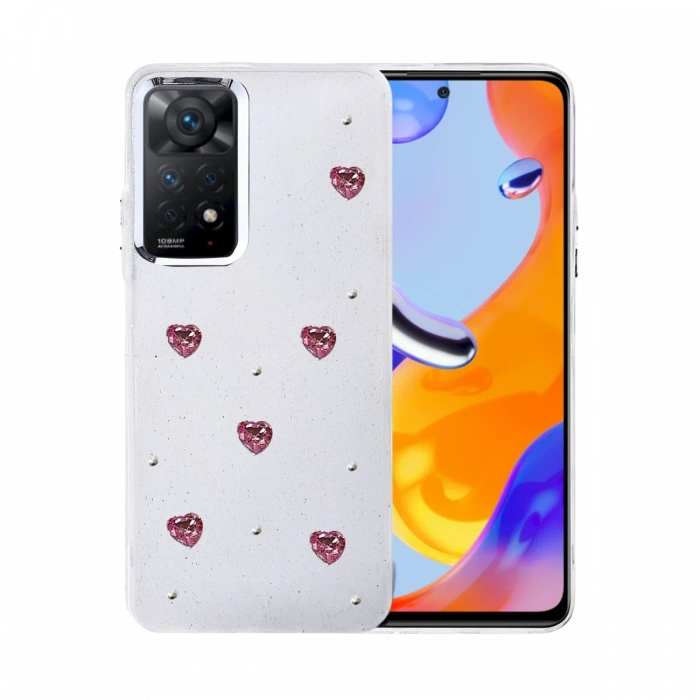 Newface Xiaomi Redmi Note 11 Pro Fiyonk Desenli Kapak