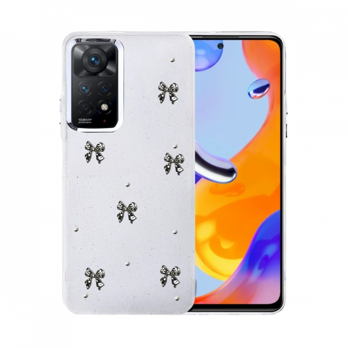Newface Xiaomi Redmi Note 11 Pro Fiyonk Desenli Kapak