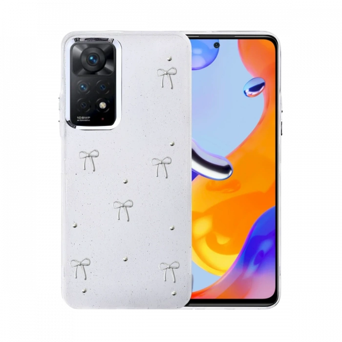 Newface Xiaomi Redmi Note 11 Pro Fiyonk Desenli Kapak