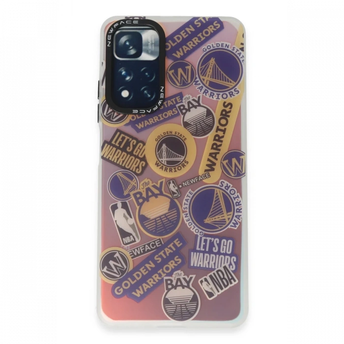 Xiaomi Redmi Note 11 Pro Kılıf Estoril Desenli Kapak