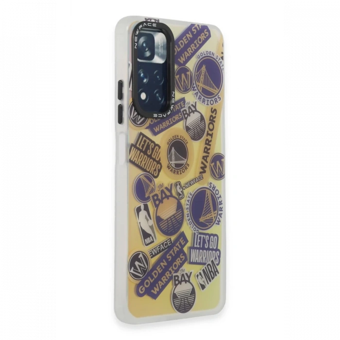 Xiaomi Redmi Note 11 Pro Kılıf Estoril Desenli Kapak