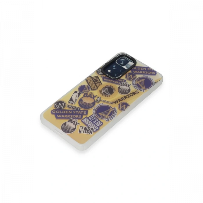 Xiaomi Redmi Note 11 Pro Kılıf Estoril Desenli Kapak