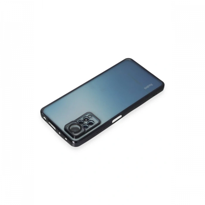 Xiaomi Redmi Note 11 Pro Kılıf Razer Lensli Silikon